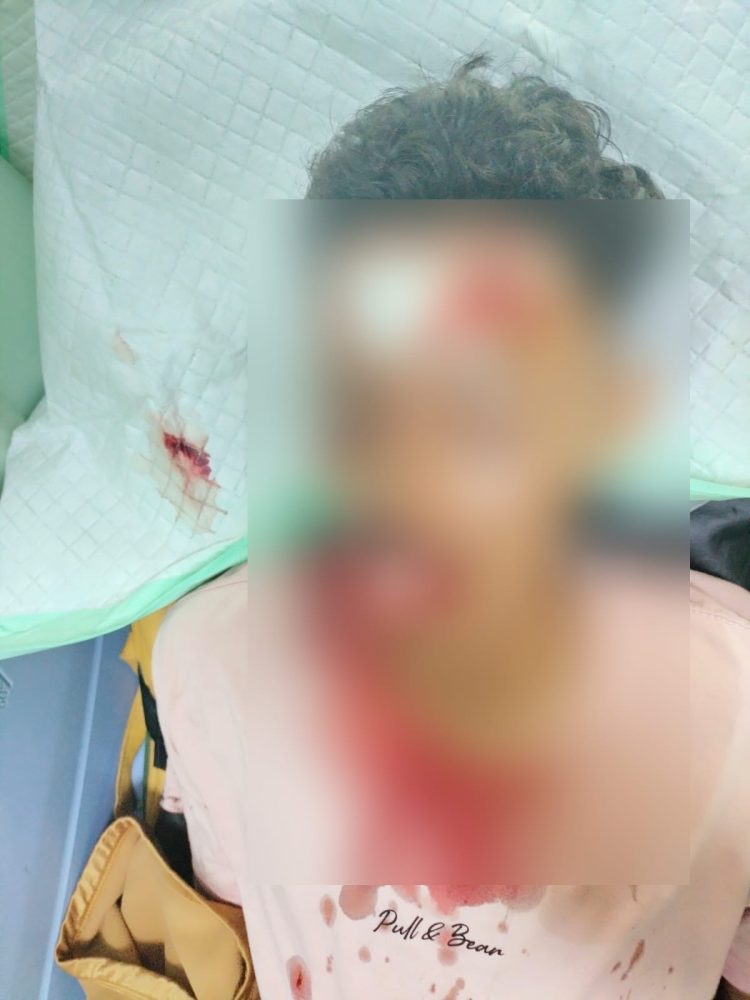 Dikira Pembacokan, Kasatlantas Polresta Pati Sebut Ternyata Laka Lantas